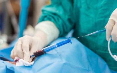 What do Vascular Surgeons Do?